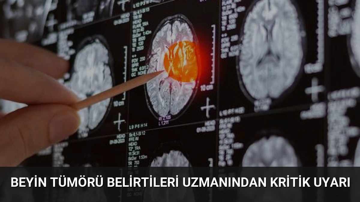 Beyin Tümörü Belirtileri Uzmanından Kritik Uyarı