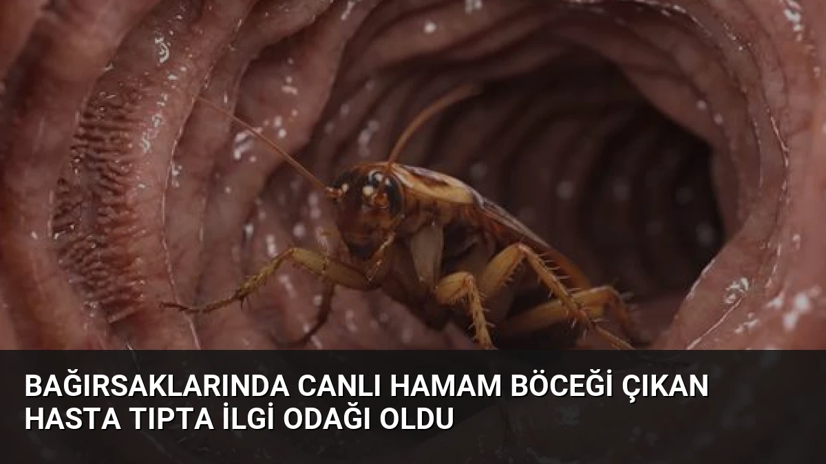 Bağırsaklarında Canlı Hamam Böceği Çıkan Hasta Tıpta İlgi Odağı Oldu