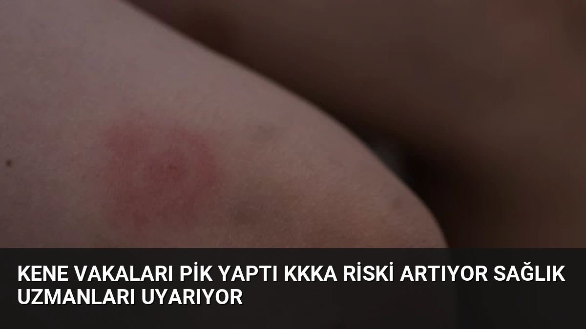 Kene Vakaları Pik Yaptı KKKA Riski Artıyor Sağlık Uzmanları Uyarıyor