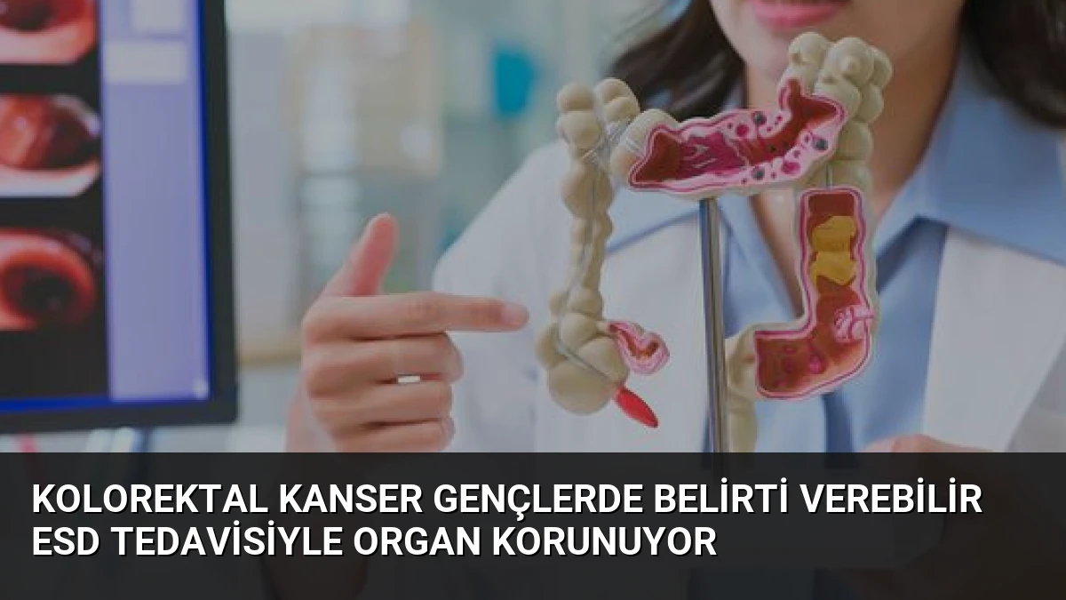Kolorektal Kanser Gençlerde Belirti Verebilir ESD Tedavisiyle Organ Korunuyor