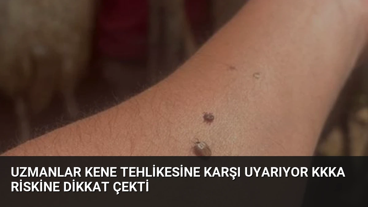 Uzmanlar Kene Tehlikesine Karşı Uyarıyor KKKA Riskine Dikkat Çekti